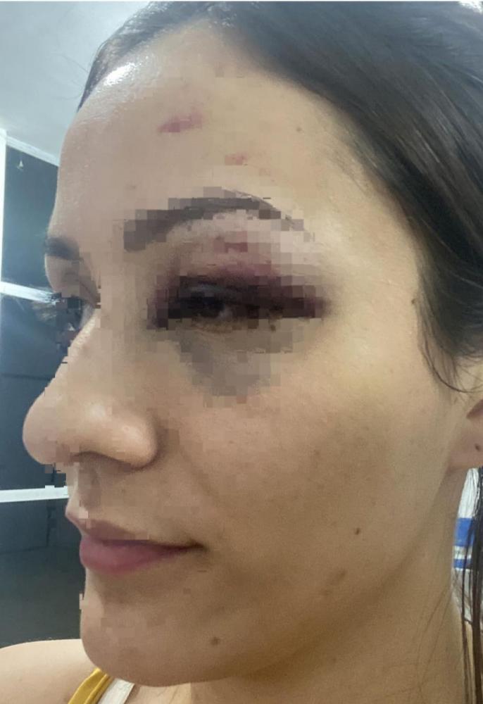 Advogado denunciado por agressão de enfermeira em Teresina é exonerado pelo TJ-PI