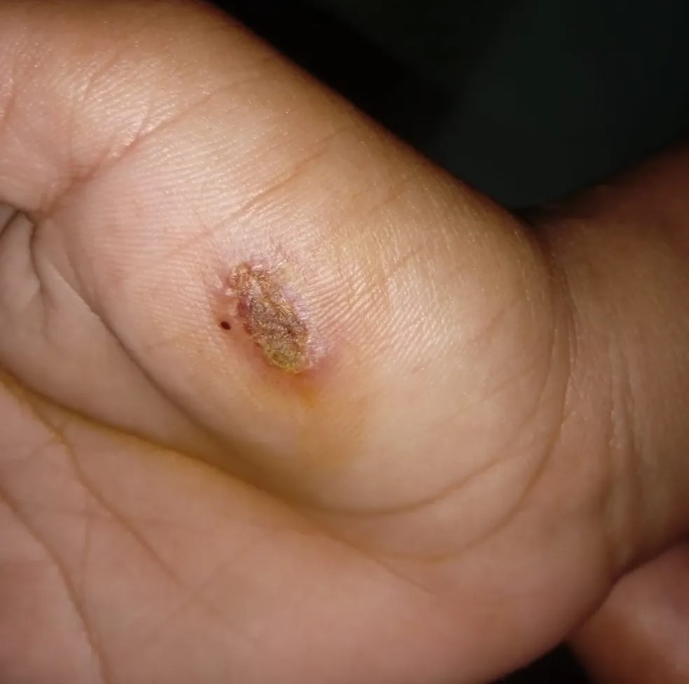 Simplício Mendes-PI: Casal é denunciado por tortura, após filha compartilhar vídeo de agressão