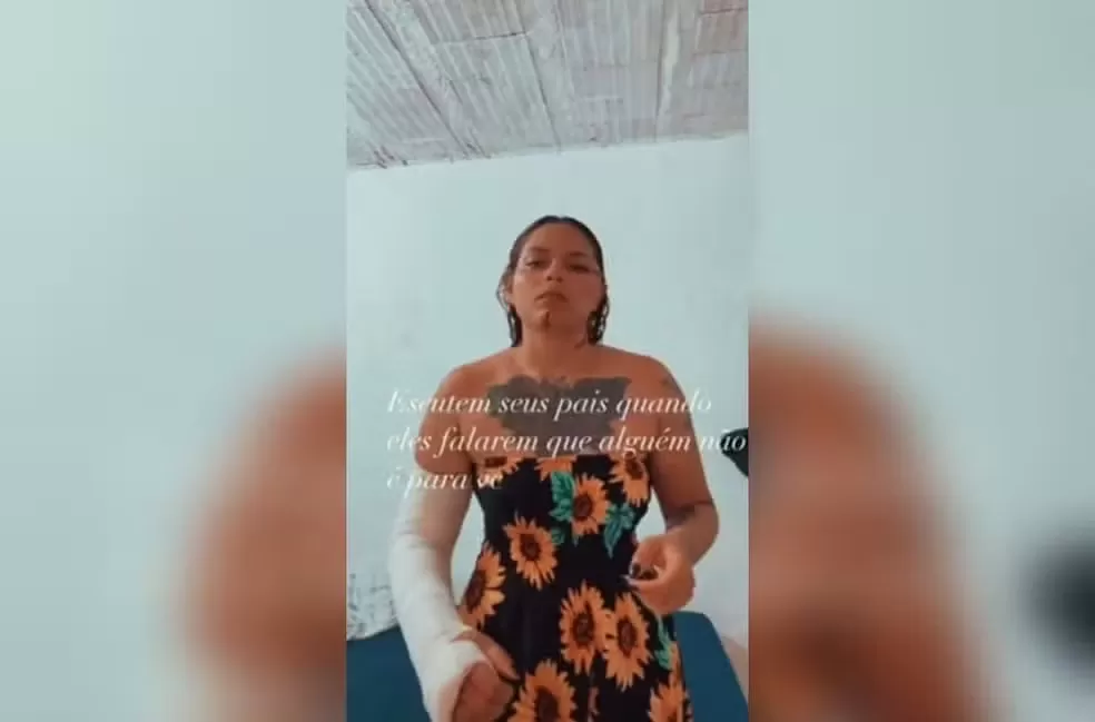 Vendedora é agredida com cacos de vidro e tem braço fraturado por namorado em bar de Fortaleza