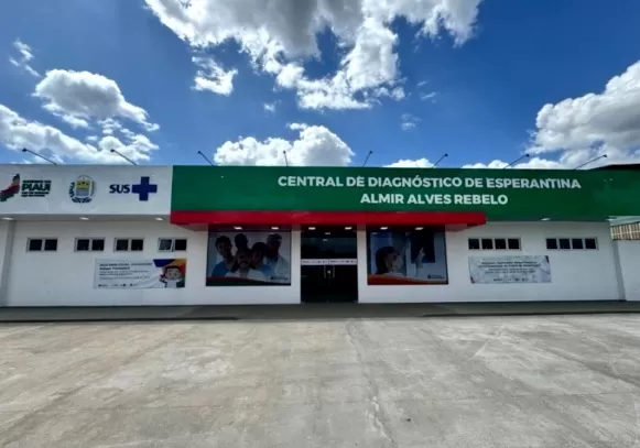  Campo Maior e mais 12 cidades serão beneficiados com Centrais de Diagnóstico de Saúde