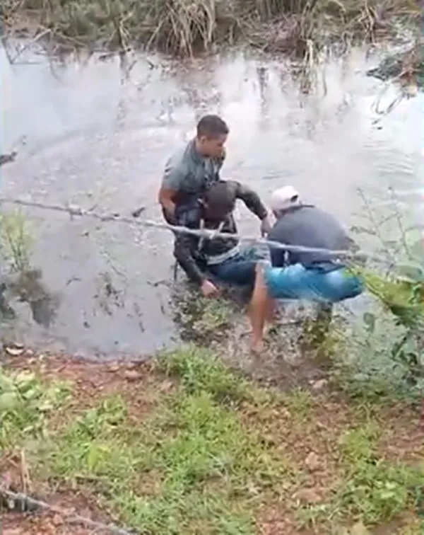 Jovem é resgatado por populares após sofrer grave acidente na zona rural de Coroatá