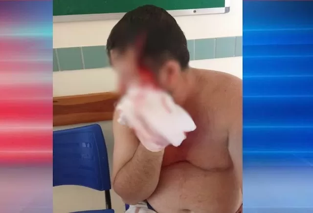 Conflito em Zona Rural de Cocal dos Alves Deixa Pai e Filho Feridos