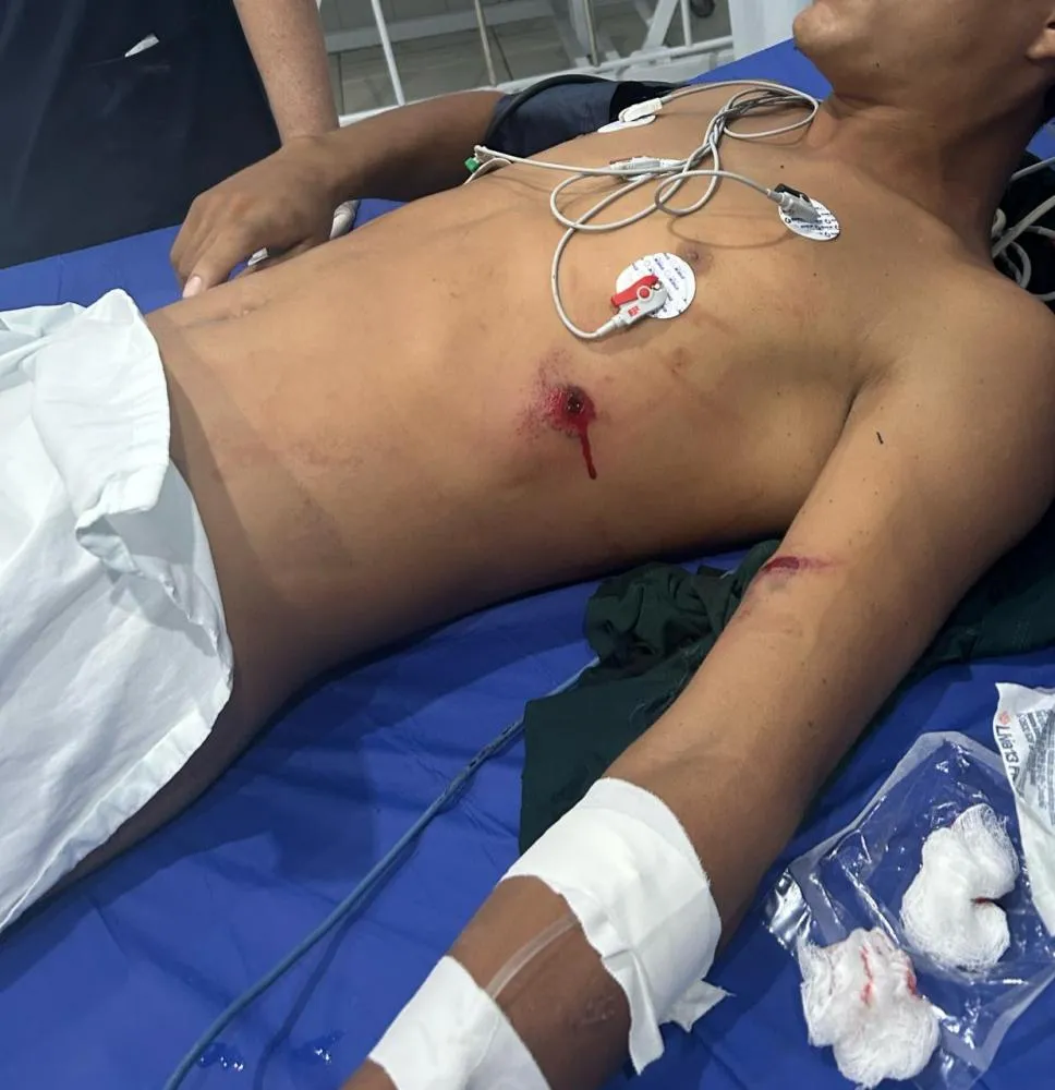 Jovem é baleado em bar na Vila Nise, em Barras, e está em estado grave