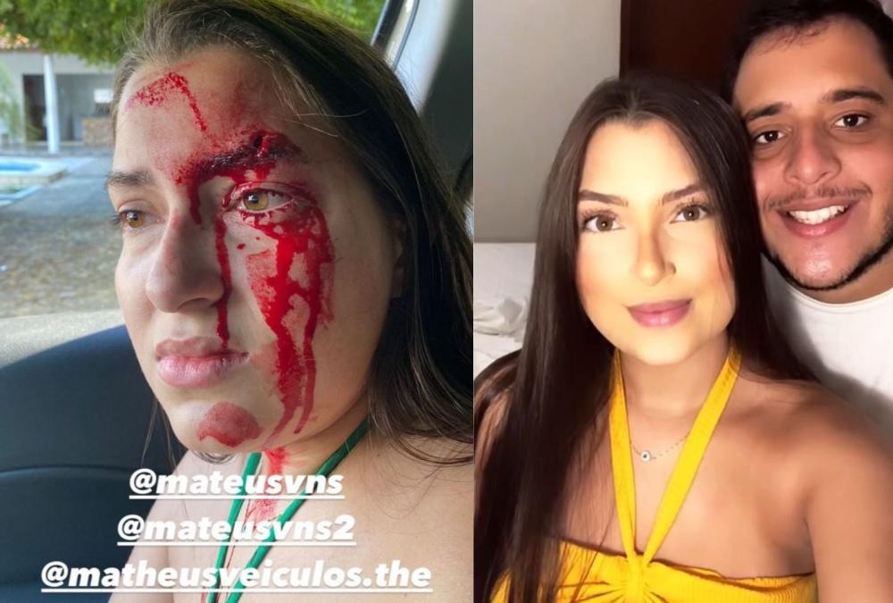 Polícia civil do Piauí prende acusado de agredir namorada