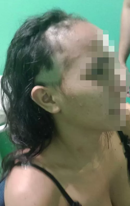 Mulher é investigada por forjar agressão e raspar o cabelo para incriminar companheiro em Matias Olímpio
