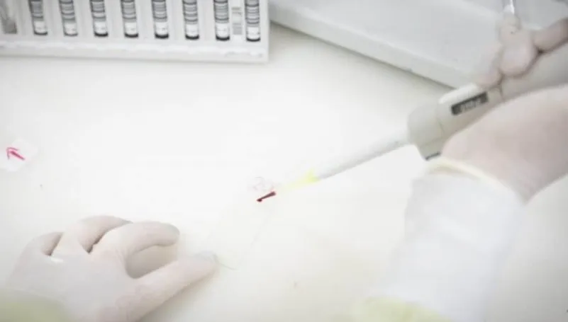 Ebola é descartado em paciente do Emílio Ribas em SP