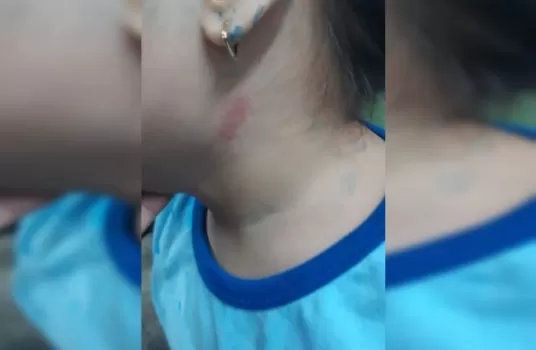 Professora acusada de agredir criança de 4 anos é afastada de escola