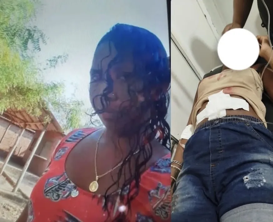 Jovem sofre tentativa de feminicídio em Esperantinópolis (MA); marido é o principal suspeito