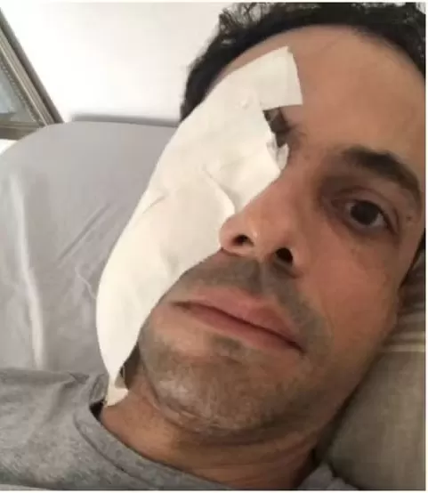 Empresário é atacado em seu trabalho com um copo de vidro e acaba levando 62 pontos no rosto 