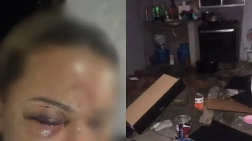 Mulher é agredida com socos pelo companheiro após discussão em São José de Ribamar