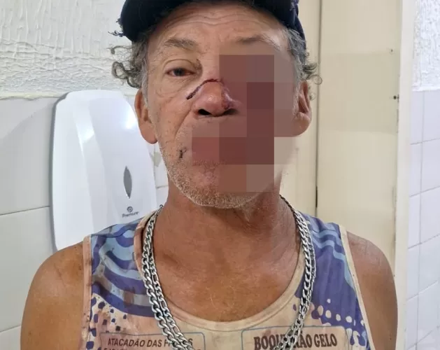 Mulher é procurada após quebrar o rosto de homem com pedrada em Boa Hora (PI)