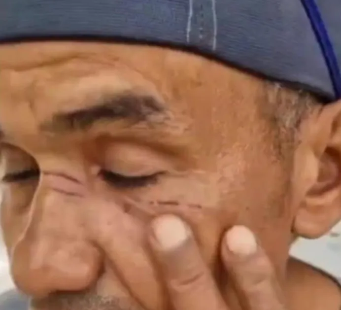 Motociclista é ferido por linha de cerol na BR-343 em Piripiri