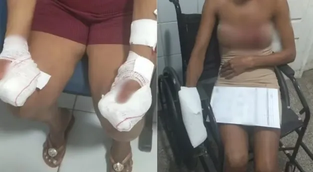 Homem é preso suspeito de agredir a mãe e a própria namorada em Codó
