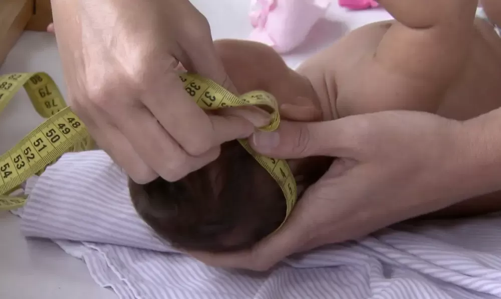 Governo regulamenta indenização e pensão a vítimas do vírus Zika