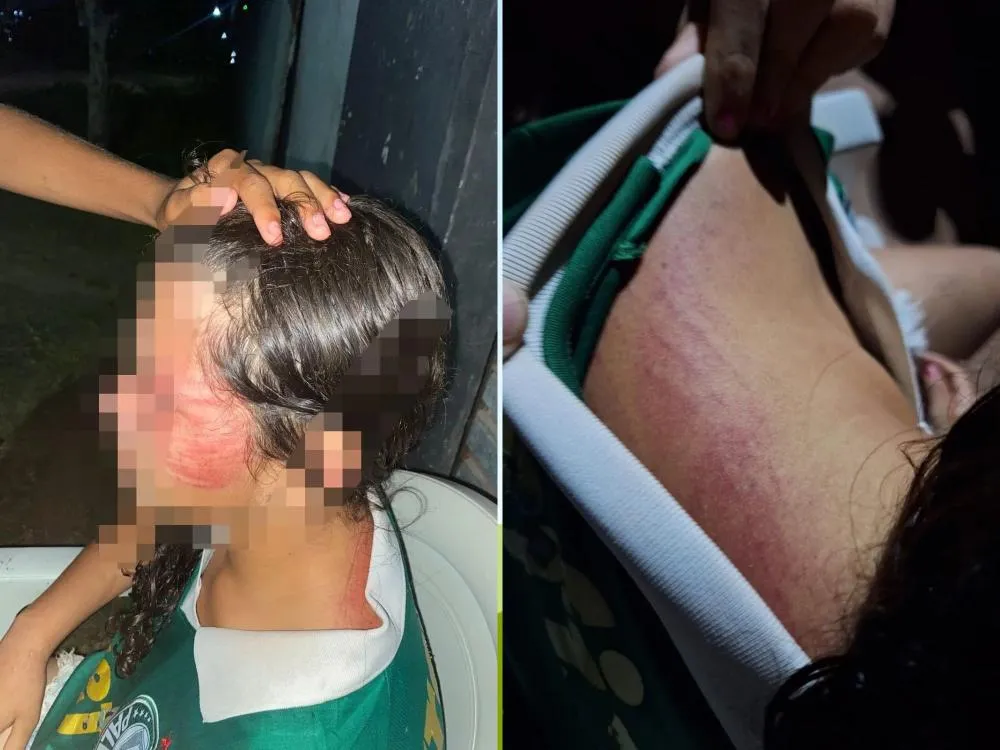 Menina de 12 Anos é Resgatada em Miguel Alves Após Suspeita de Maus-Tratos