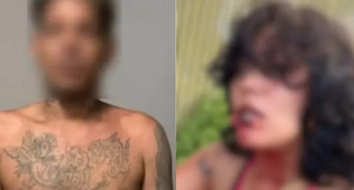 Homem é preso suspeito de arrancar parte do lábio da companheira com mordida em São Luís