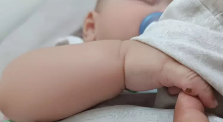 Bebê vai a hospital para operar dedo extra, mas médica erra cirurgia