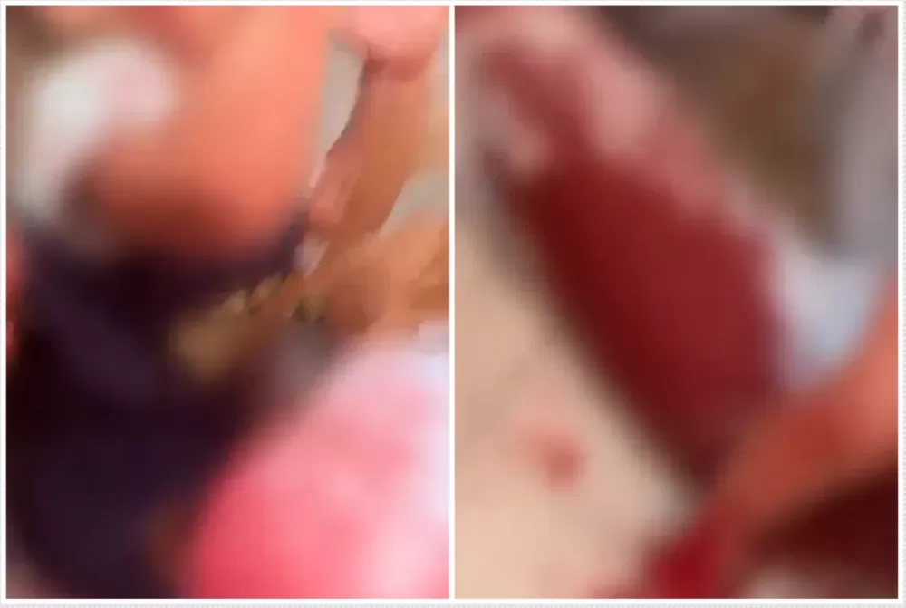 Foto: Reprodução/Redes Sociais